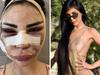 ‘I spent $800k to look like Kim K’