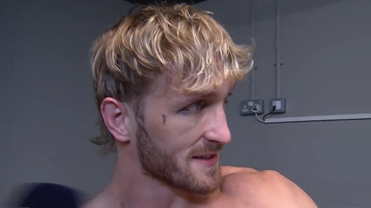 Logan Paul shows off the nasty cut on his face. Photo: DAZN.