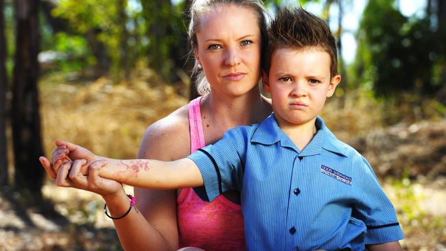 Samantha Cooper was shocked when her son Benjamin Horsington (6) returned from Bali with a "black henna" tattoo that left scars on his arm along with life-long allergies due to the chemicals used with Black-Henna.