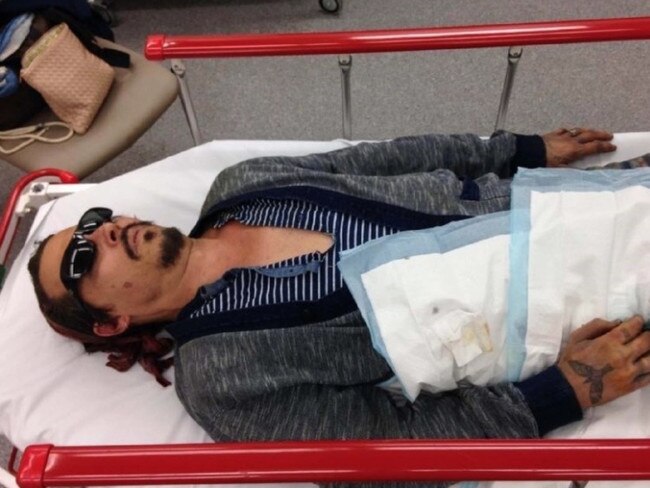 Handout photo released by Johnny Depp's lawyers show him in hospital with a severed finger. Picture: Schillings