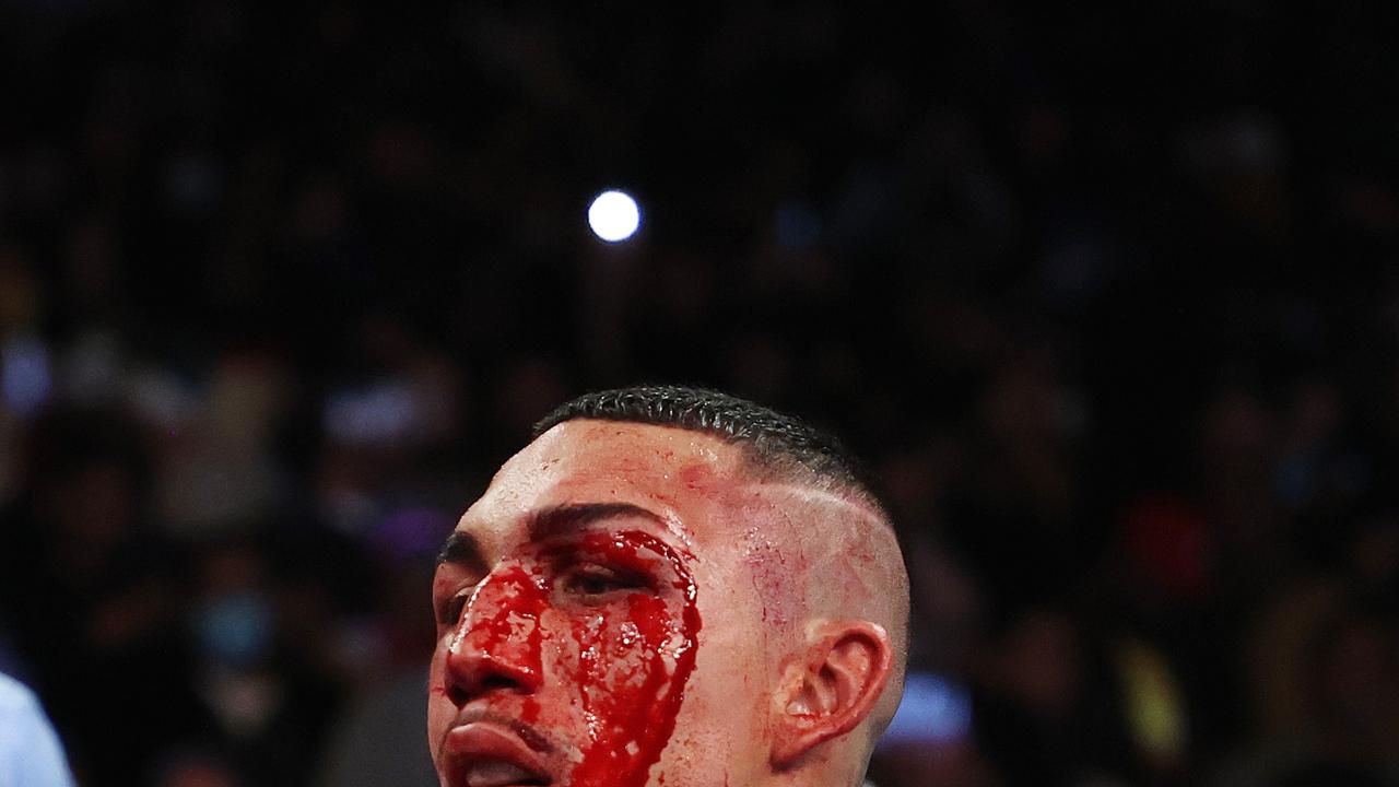 NEW YORK, NEW YORK - NOVEMBER 27: Teofimo Lopez stands bloodied after his bout against George Kambosos for Lopezâ&#128;&#153;s Undisputed Lightweight title at The Hulu Theater at Madison Square Garden on November 27, 2021 in New York, New York. Al Bello/Getty Images/AFP == FOR NEWSPAPERS, INTERNET, TELCOS &amp; TELEVISION USE ONLY ==