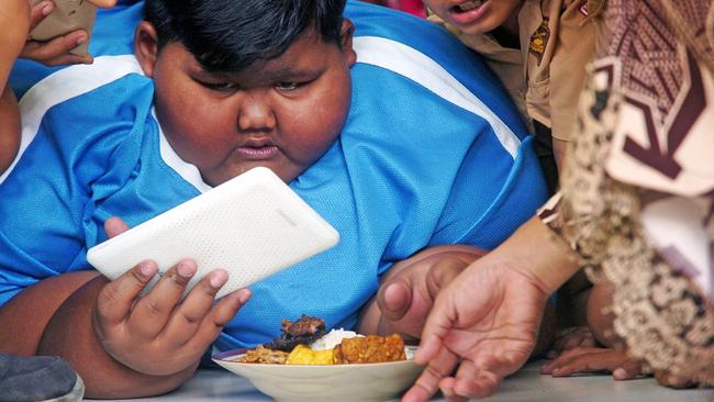 Permana’s dietitian has reduced his diet and increased his physical activity. Picture: Caters