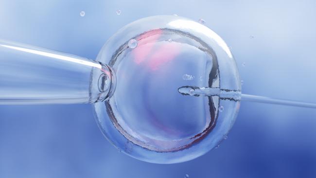 IVF (in vitro fertilization) or insemination of female egg with microscope
