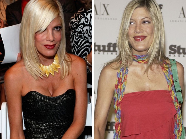 Tori Spelling opens up about boob job at 19.