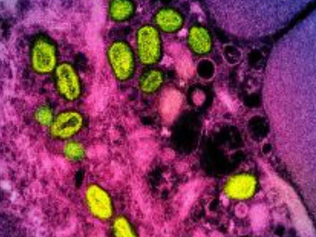 A colorised transmission electron micrograph of monkeypox particles (green) found within an infected cell (pink and purple), cultured in the laboratory. Picture: AFP