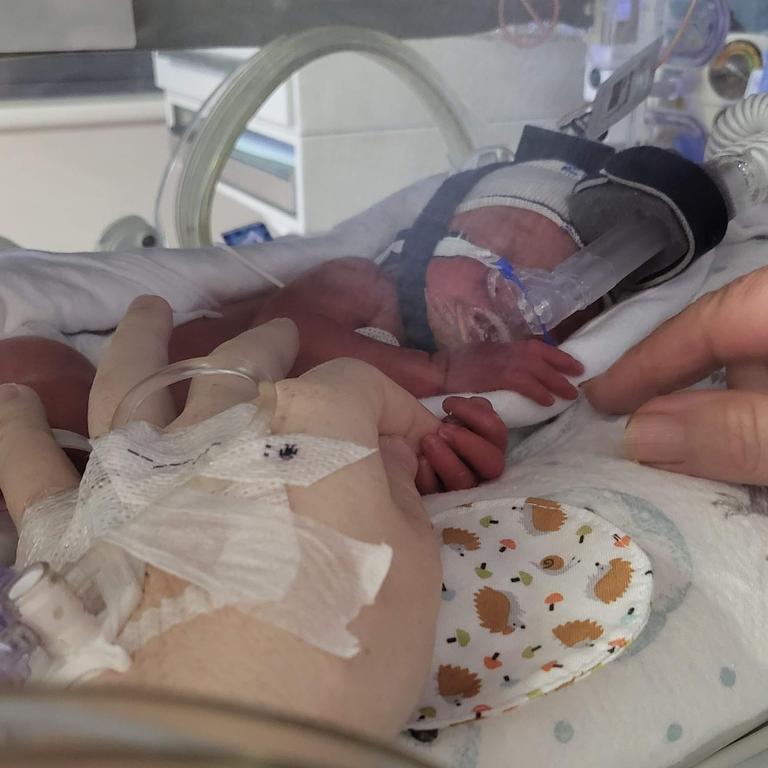 The girls had very few complications associated with their prematurity. Picture: Evette Matthews