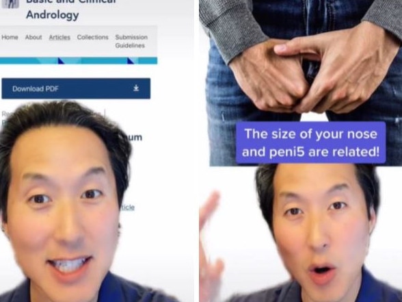 The US doctor previously revealed the size of a man’s nose can indicate the size of his penis. Picture: TikTok/@tonyyounmd