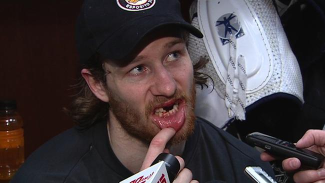 Grin and bear it: NHL players say losing teeth part of game