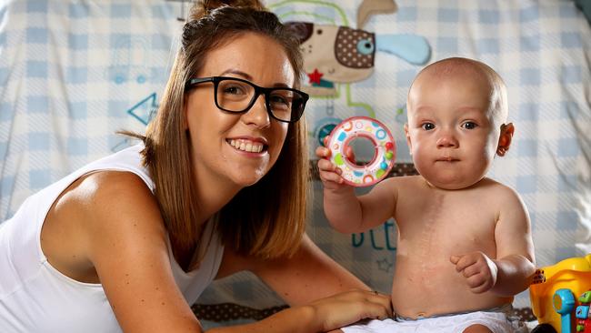 Joshua McGivern with mother Elaine at home in North Lakes sporting a scar on his chest. Picture: Adam Head