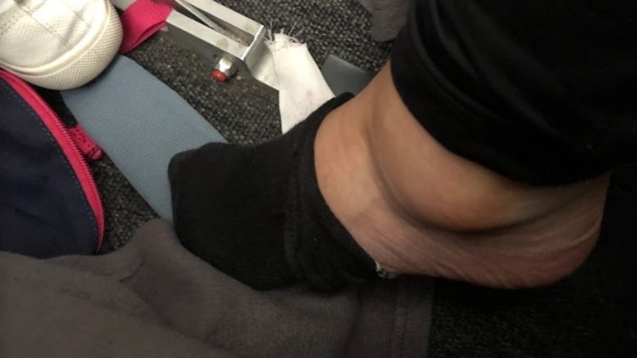 Leg and foot swelling during a flight is common, according to the Mayo Clinic. Picture: news.com.au