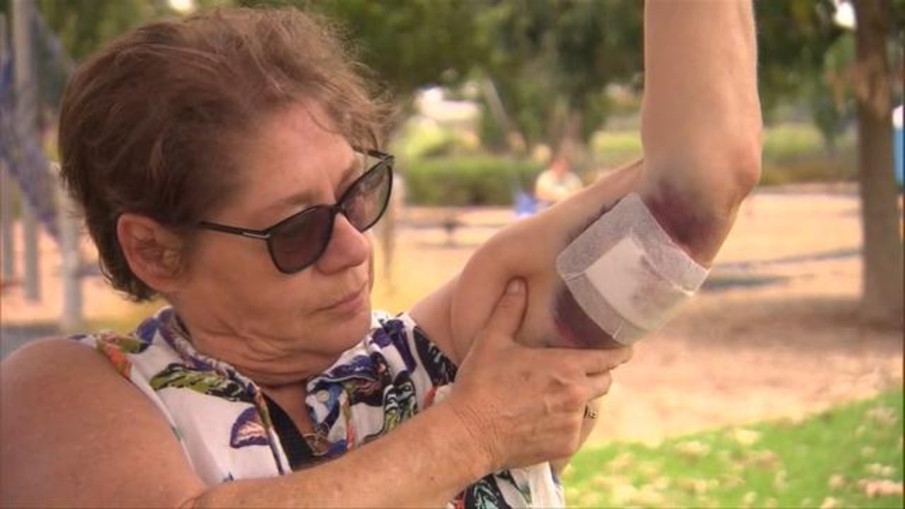 Grandmother’s horror injuries after dog attack