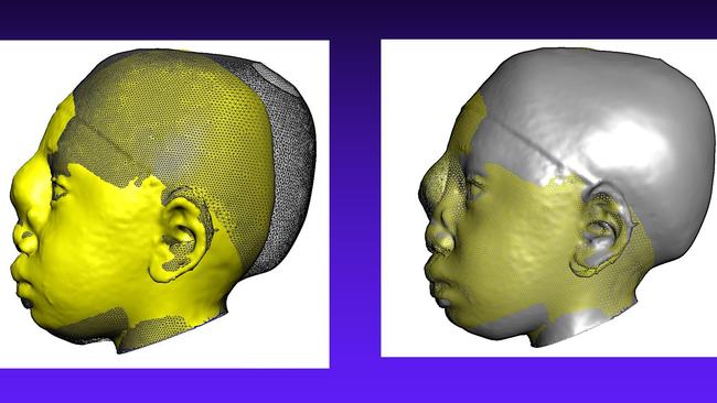 The before and after medical scans. Picture: Royal Children’s Hospital