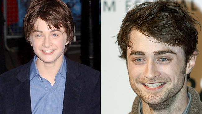 Eight Former Child Stars Stuck With Their Kid Faces 