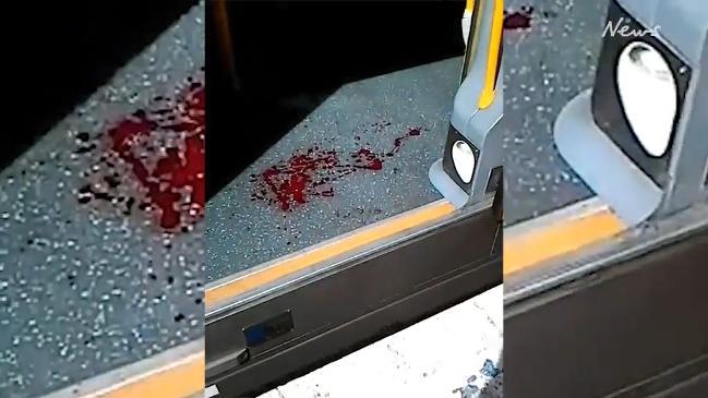 Blood spatter throughout Richmond Train