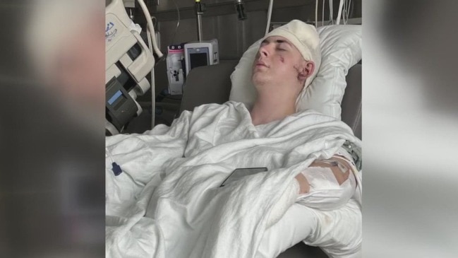 Texas teen survived machete attack, speaks out | news.com.au ...