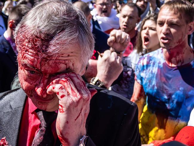 Sergey Andreev wipes his eye after being splattered with a red substance. Picture: AFP