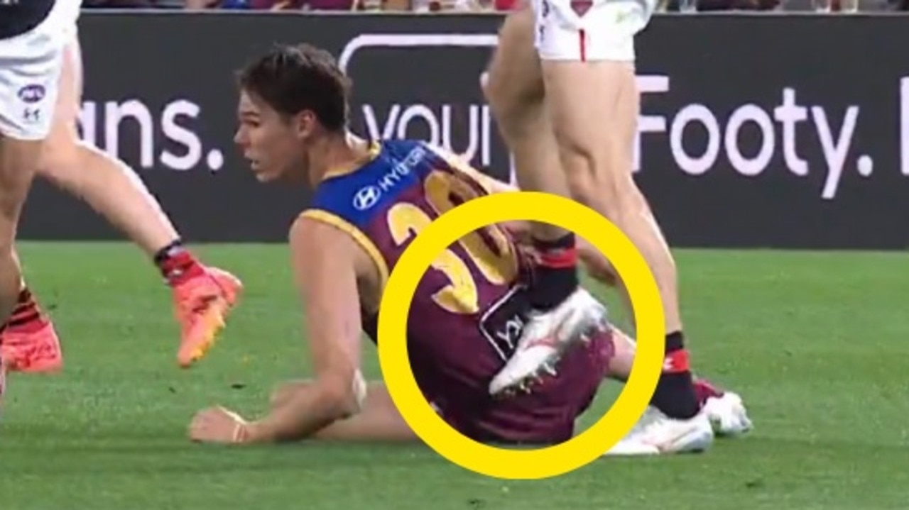 Bombers defender called out over ugly mid-game act