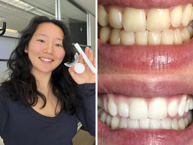 SmilePro Advanced Whitening Kit. Picture: Supplied/Cindy Du, /Smile Pro