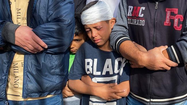 A wounded Palestinian boy cries as he joins prayers for the casualties of Israeli strikes. Picture: AFP