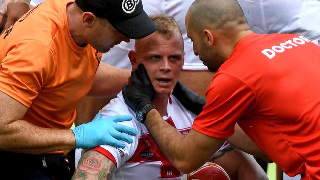 Kevin Brown of England is seen by team medics after a heavy tackle.