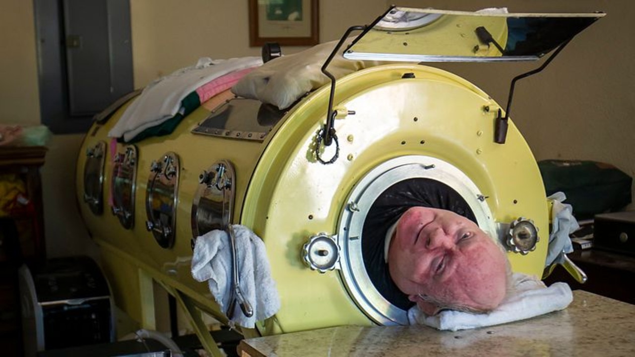 Paul Alexander, who lived in an iron lung for 70 years, became a lawyer ...