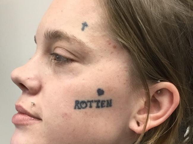 Ms Wright is getting all three of her face tattoos lasered off.