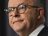 Bond: Albo either loves this minister or hates her guts