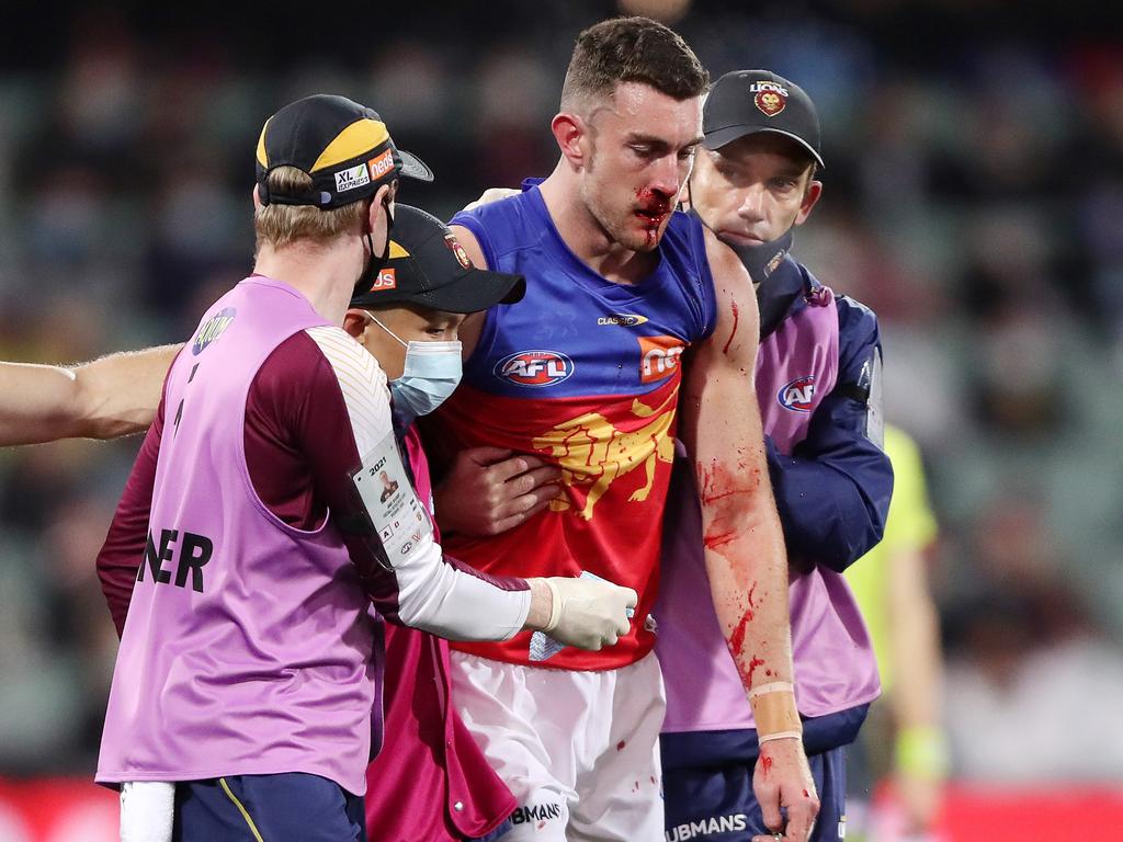 The Lions already lost key forward Eric Hipwood to injury earlier in the season, and now they’ve lost McStay. (Photo by Sarah Reed/AFL Photos via Getty Images)