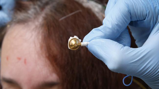 Neurologists glue the electrodes into place on Janina Freestone’s head. Picture: David Caird