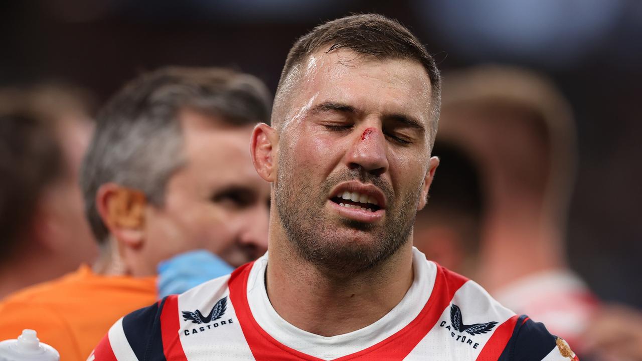 SYDNEY, AUSTRALIA - MARCH 30: James Tedesco of the Sydney Roosters is given medical assistance during the round five NRL match between the Sydney Roosters and the Parramatta Eels at Allianz Stadium on March 30, 2023 in Sydney, Australia. (Photo by Mark Kolbe/Getty Images)