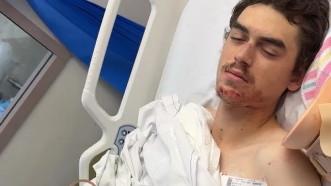 Kyle Bugatto sustained multiple broken bones and a spine fracture as a result of the crash. Picture: GoFundMe