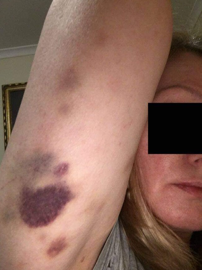 Images of a woman who alleges she was assaulted by police while being arrested for breaching COVID-19 restrictions. Picture: Facebook.