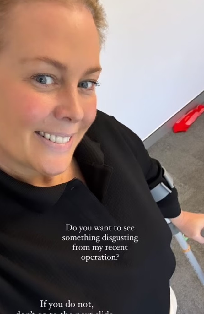 ‘So much pain’: Horror find in Sam Armytage’s surgery | news.com.au ...