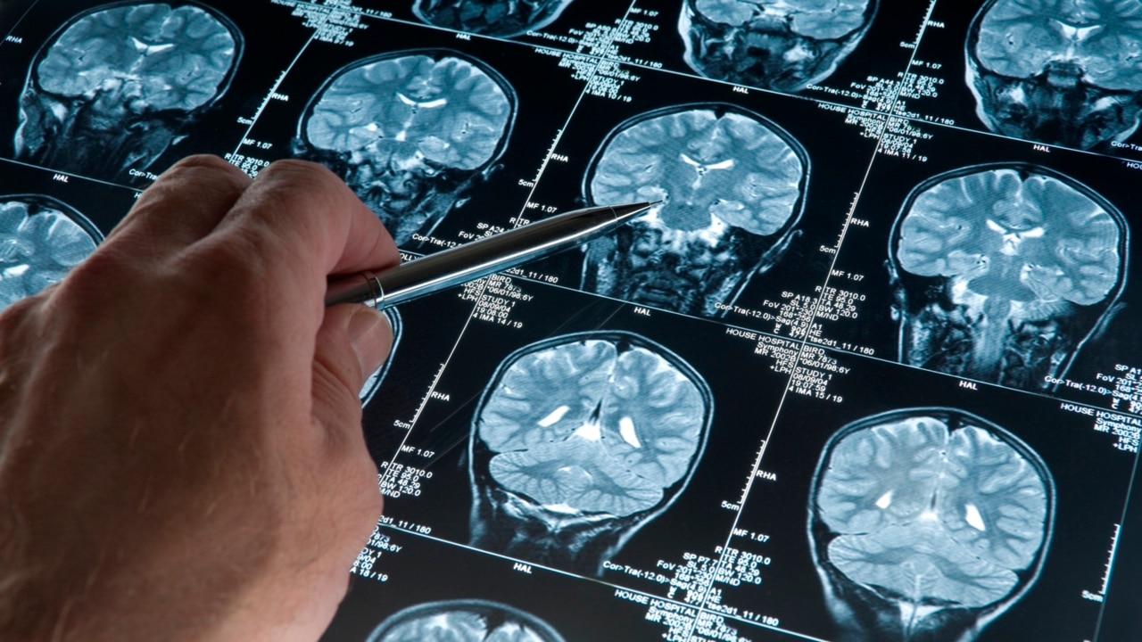 Alzheimer's vaccine beginning human trials