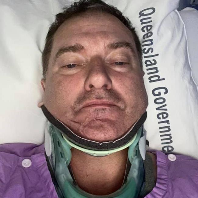 Wide Bay Federal MP, Llew O'Brien shared images to social media of him in hospital following a crash involving his motorcycle and a vehicle at Lakeside Raceway on Saturday.