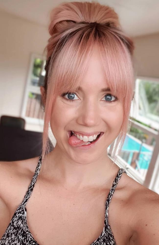 Alopecia Woman Shares Amazing Hair Loss Journey On Instagram News