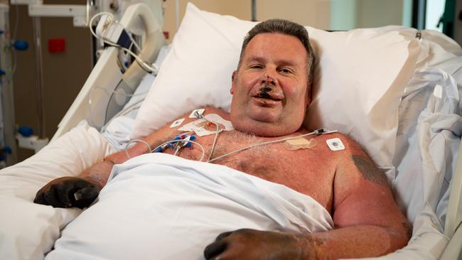 Jason ‘Buddy’ Miller taken in the ICU at Northern Beaches Hospital in Frenchs Forest, is grateful to staff for saving his life. Picture: Julian Andrews.