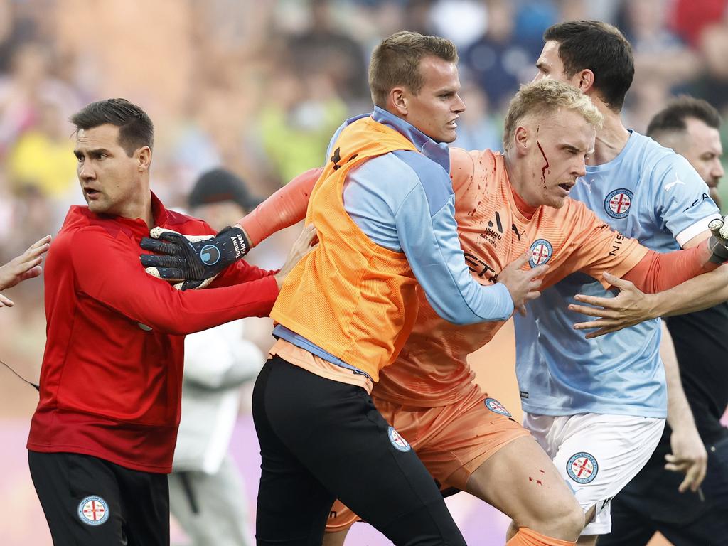 Bleeding goalkeeper Tom Glover is escorted off the ground after being assaulted during the Melbourne derby pitch invasion. Picture: Darrian Traynor/Getty Images