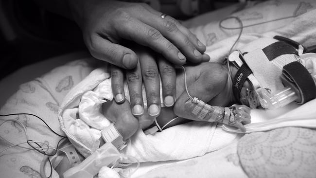Baby Isla was born at 29 weeks. (Pic: Ric Frearson)