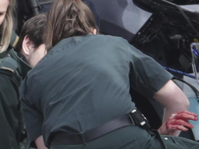 A bloodied hand emerges as a person is treated at the scene outside the Houses of Parliament in London. Picture: AP