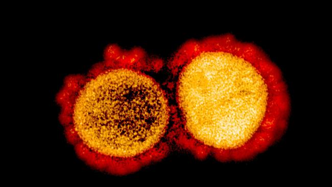 A transmission electron micrograph of SARS-CoV-2 virus particles, isolated from a patient. Picture: US National Institute of Allergy and Infectious Diseases / AFP