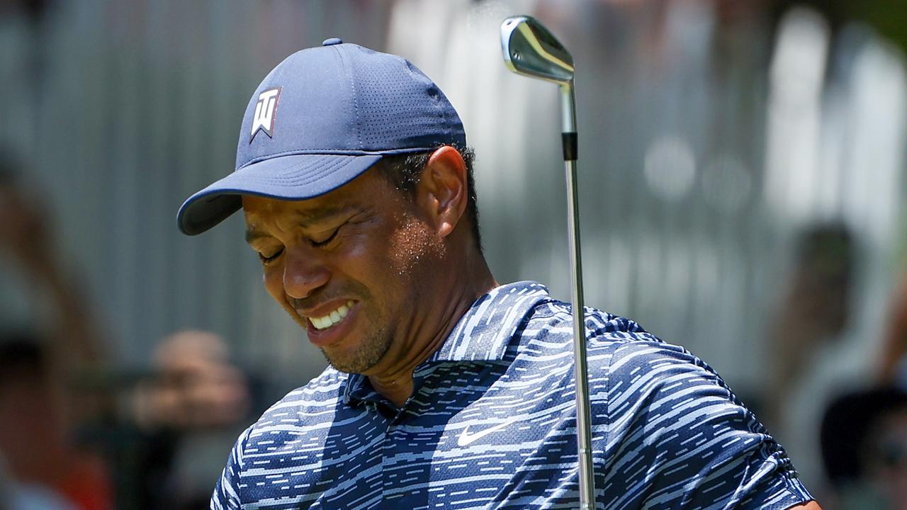 Photo reveals true extent of Tiger Woods’ leg injury after accident