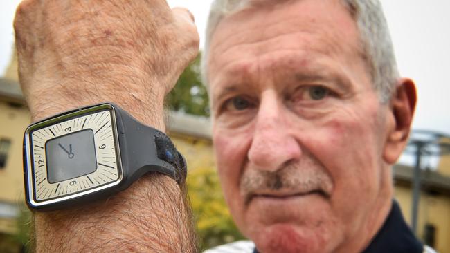 Dr Philip Berger with the new watch monitor. Picture: Tony Gough