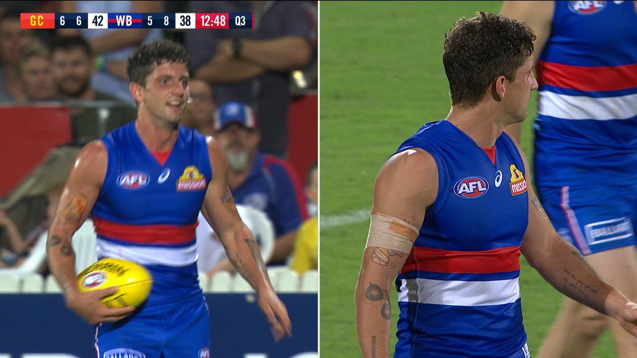 Tom Liberatore is fine - Homer Simpson had to get bandaged up against the Suns, though.