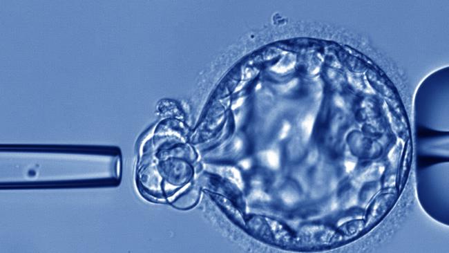 A test developed by the Monash IVF Group that was meant to reduce miscarriages was suspended and a class action over its use settled.