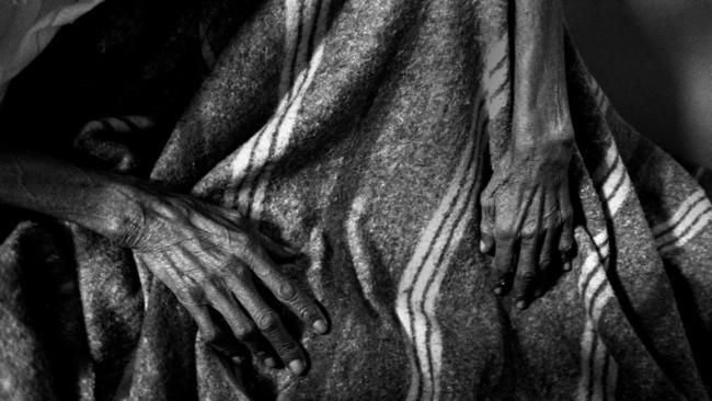 The hands of a patient dying from AIDS at local hospital in Bukavu, Congo, in June 2006. Picture: Antonin Kratochvil