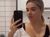 Model’s nightmare after boob job