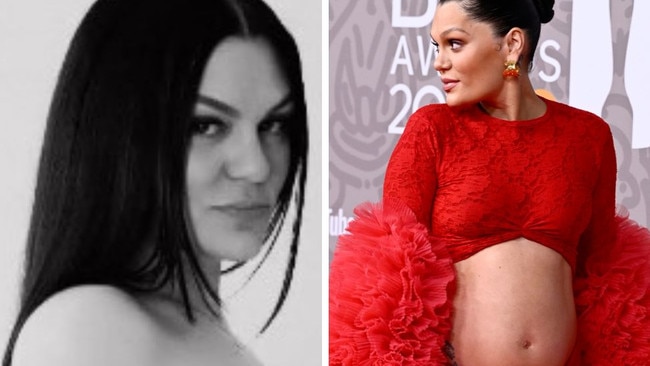 Jessie J shares photo of body after birth.