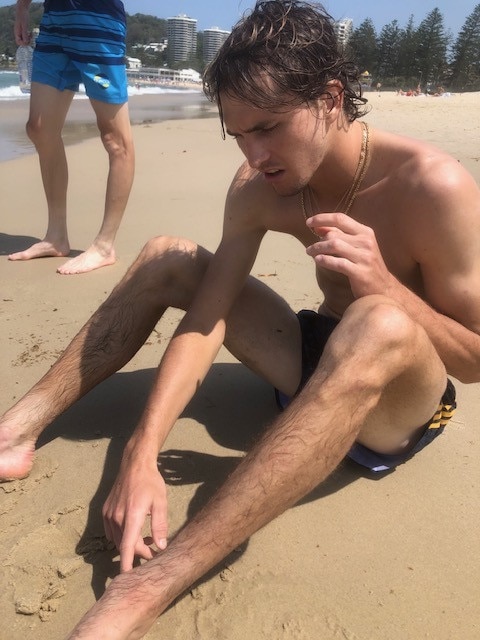 German tennis star Alexander Zverev recovers from a bluebottle sting. Supplied