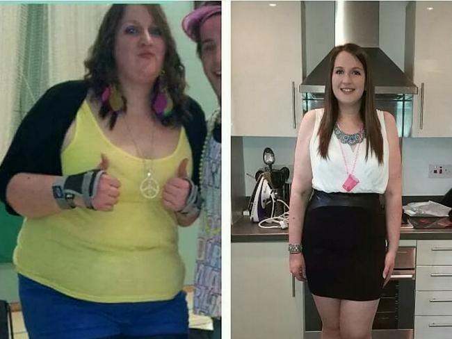 Louise Horton before and after her weight loss.